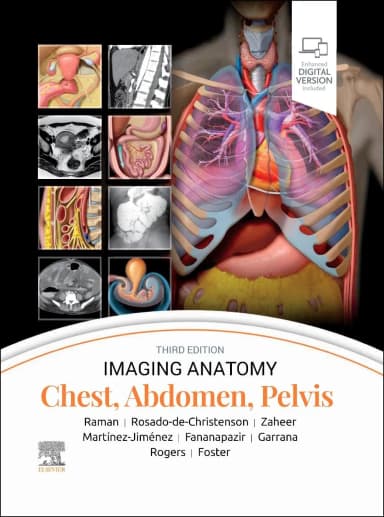 Image of - Imaging Anatomy: Chest, Abdomen, Pelvis-3E