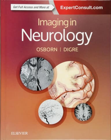 Image of - Imaging in Neurology