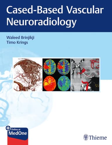 Image of - Imaging in Neurovascular Disease 1st Ed.