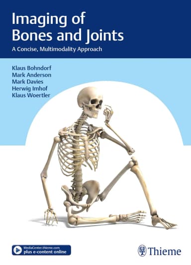 Image of - Imaging of Bones and Joints : A Concise, Multimodality Approach 1st Edition