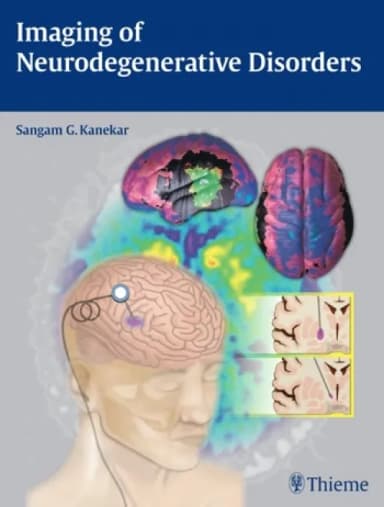 Image of - Imaging of Neurodegenerative Disorders - 1st Edition