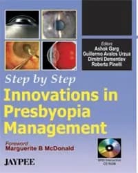 Step By Step Innovations In Presbyopia Management with Cd-rom - 1st Edition