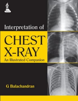 interpretation-chest-x-ray-illustrated-companion-1st-edition