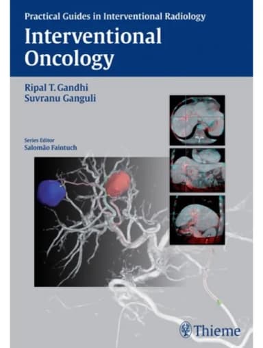 Thumbnail - Interventional Oncology - 1st Edition