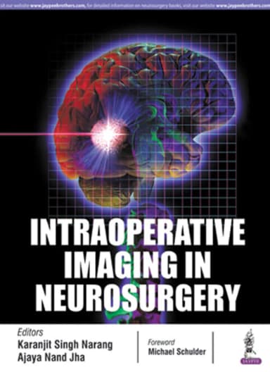 Image of - Intraoperative Imaging in Neurosurgery