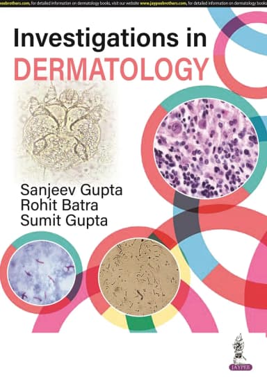 Image of - Investigations in Dermatology