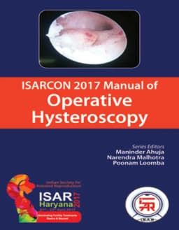 isarcon-2017-manual-of-operative-hysteroscopy
