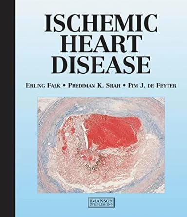 Image of - Ischaemic Heart Disease - 1st Edition