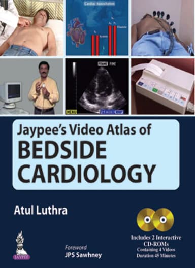 Image of - Jaypees Video Atlas of Bedside Cardiology