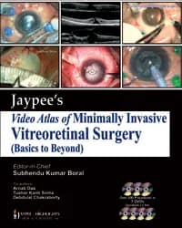 Thumbnail - JAYPEE VIDEO ATLAS OF MINIMALLY INVASIVE VITREORETINAL SURGERY