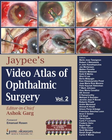 Image of - Jaypee's Video Atlas Of Ophthalmic Surgery Vol.2 With 12 Dvd Roms