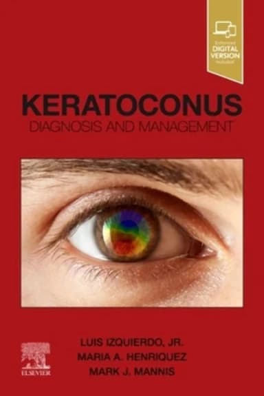 Image of - Keratoconus: Diagnosis and Management - 1E