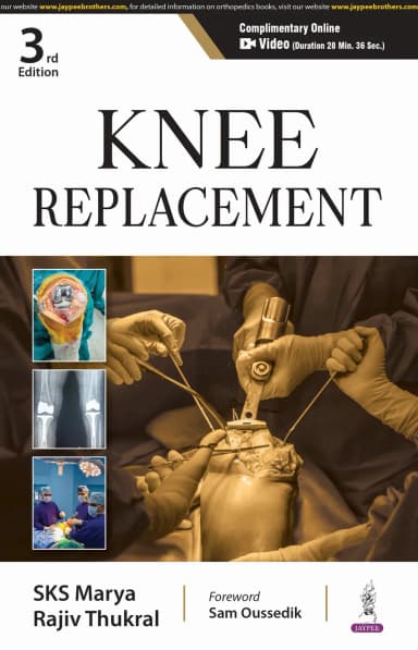 Image of - Knee Replacement