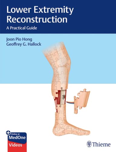 Image of - Lower Extremity Reconstruction - A Practical Guide1st Ed.