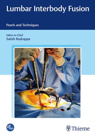 Image of - Lumbar Interbody Fusion 1st Ed.