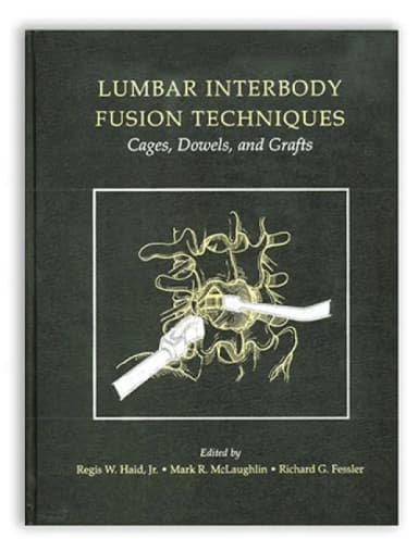 Image of - Lumbar Interbody Fusion Techniques: Cages, Dowels, and Grafts - 1st Edition