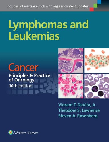 Image of - Lymphomas and Leukemias: Cancer:  Principles and Practice of Oncology, 10th edition