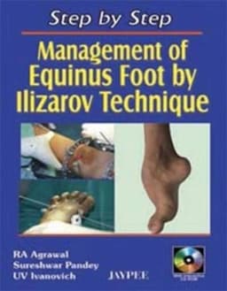 management-equinus-foot-llizarov-technique-1st-edition