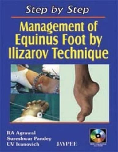 Image of - Step by Step Management of Equinus Foot by Ilizarov Technique With Cd Rom