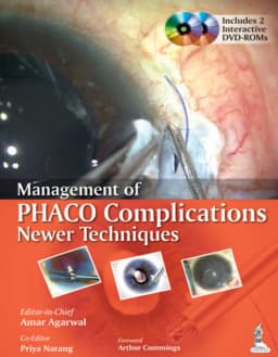 management-of-phaco-complications-newer-techniques