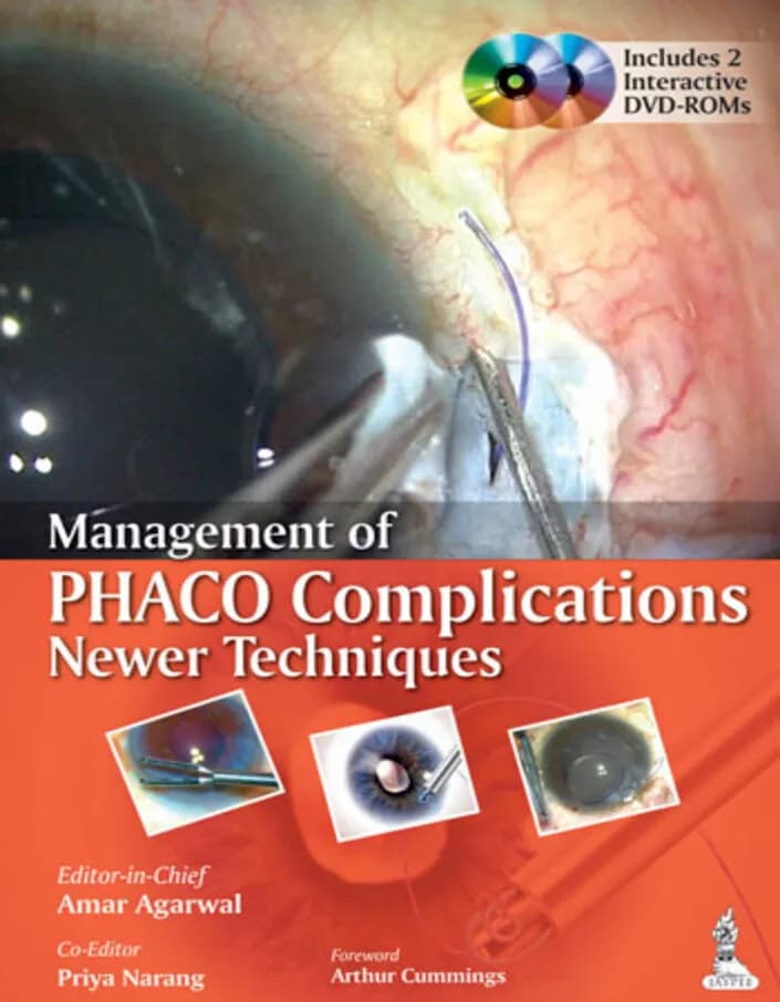 Management of Phaco Complications and Newer Techniques - 1st Edition