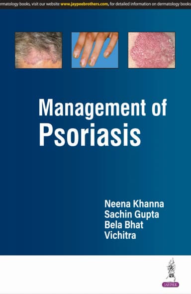Image of - Management of PSORIASIS