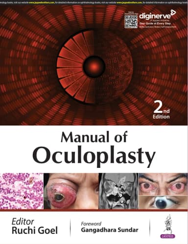 Image of - Manual of Oculoplasty