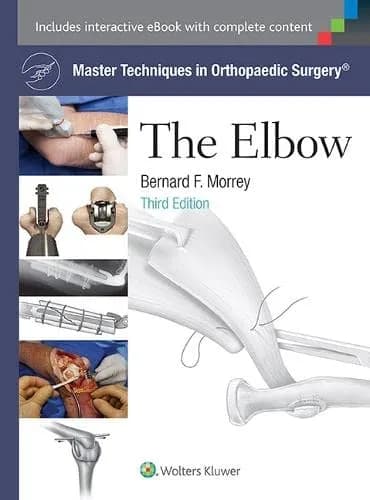 Image of - Master Techniques in Orthopaedic Surgery - The Elbow