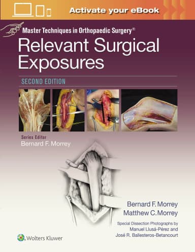 Image of - Master Techniques in Orthopaedic Surgery: Relevant Surgical Exposures -2nd Edition
