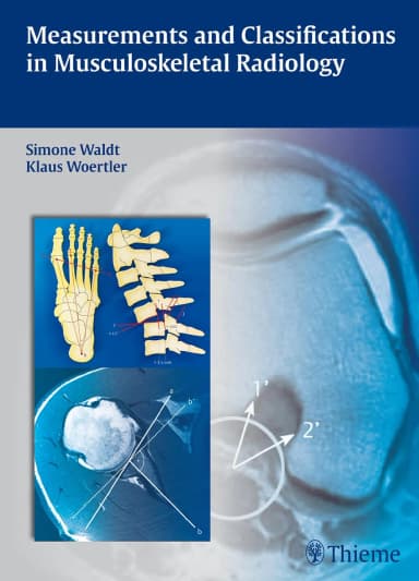 Image of - Measurements and Classifications in Musculoskeleta