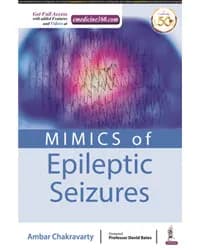 Image of - MIMICS OF EPILEPTIC SEIZURES