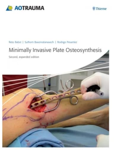 Image of - Minimally Invasive Plate Osteosynthesis (MIPO) - 2nd Edition