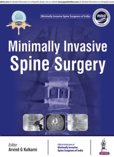 Image of - Minimally Invasive Spine Surgery