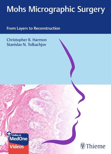 Image of - Mohs Micrographic Surgery: From Layers to Reconstruction 1st Ed.