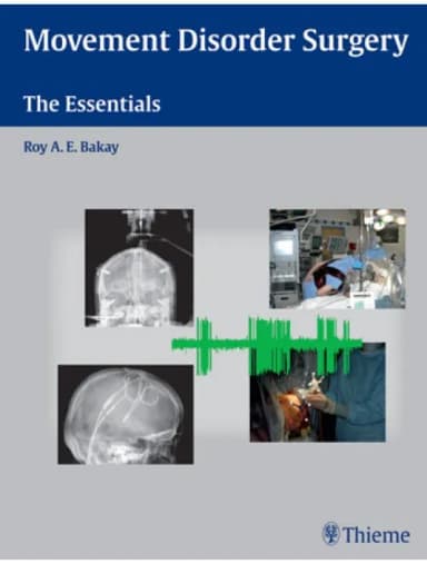 Image of - Movement Disorder Surgery - 1st Edition