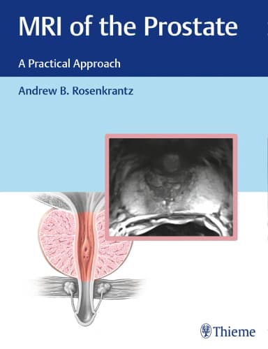 Image of - MRI of the Prostate A Practical Approach 1st Edition