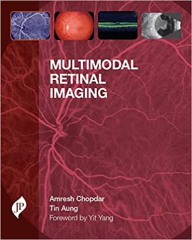 Thumbnail - MULTIMODAL RETINAL IMAGING