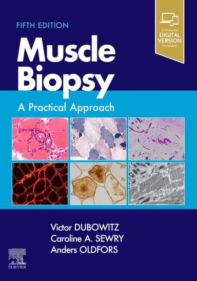 Image of - Muscle Biopsy A Practical Approach 5th Edition 