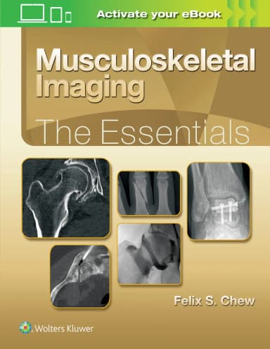 Image of - Musculoskeletal Imaging: The Essentials -1st Edition