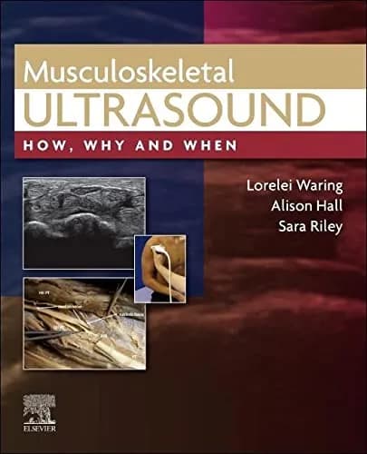 Musculoskeletal Ultrasound - 1st Edition
