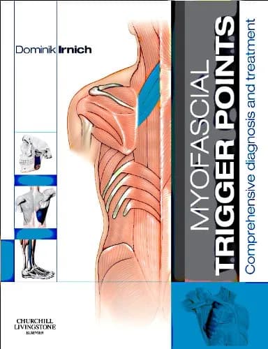 Image of - Myofascial Trigger Points Comprehensive Diagnosis and Treatment - 1st Edition