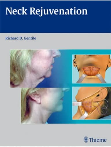 Image of - Neck Rejuvenation - 1st Edition