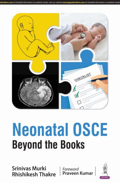 Image of - Neonatal OSCE | Beyond the Books