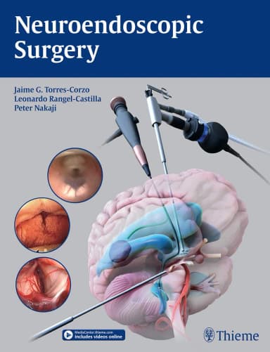 Image of - Neuroendoscopic Surgery - 1st Edition