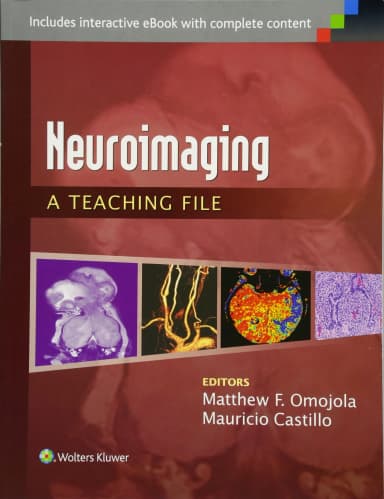 Image of - Neuroimaging: A Teaching File | 1st Edition