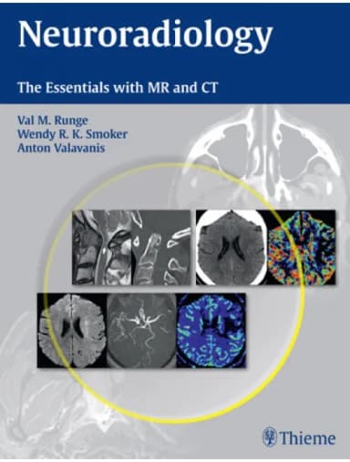 Image of - Neuroradiology-The Essentials with MR and CT - 1st Edition