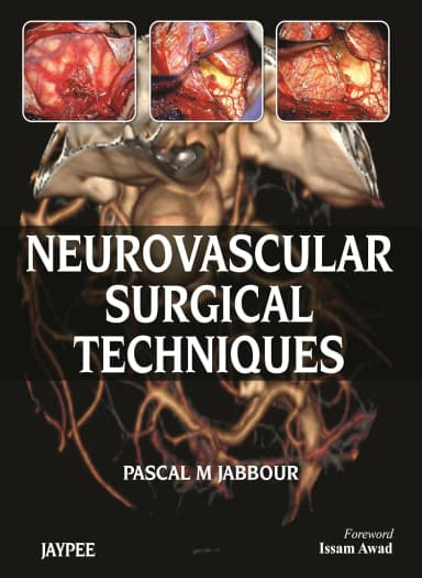 Image of - Neurovascular Surgical Techniques - 1st Edition 2013