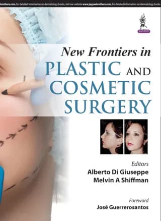 New Frontiers in Plastic and Cosmetic Surgery - 1st Edition