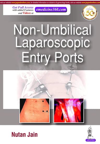 Image of - Non-Umbilical Laparoscopic Entry Ports - 1st Edition 2020