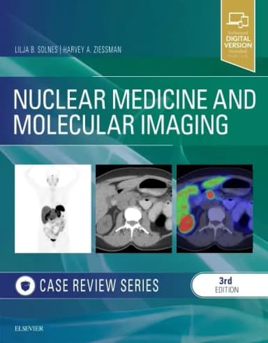 Image of - Nuclear Medicine and Molecular Imaging: Case Review Series-3E